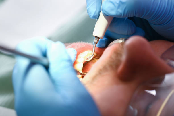 Best Root Canal Emergency Dentist  in Hillburn, NY